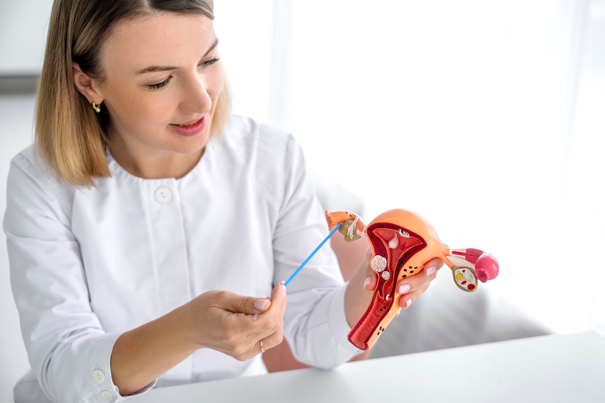 Der Gynäkologe zeigt den Aufbau und die Funktionsweise der Eierstöcke am anatomischen Modell der Gebärmutter